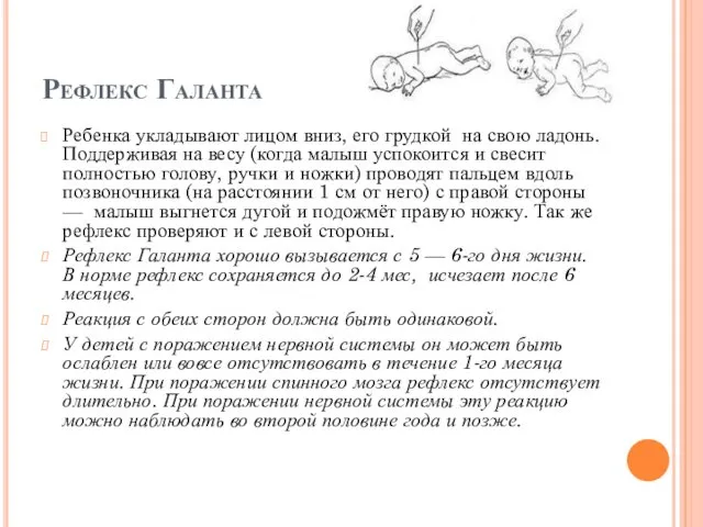 Рефлекс Галанта Ребенка укладывают лицом вниз, его грудкой на свою ладонь. Поддерживая на