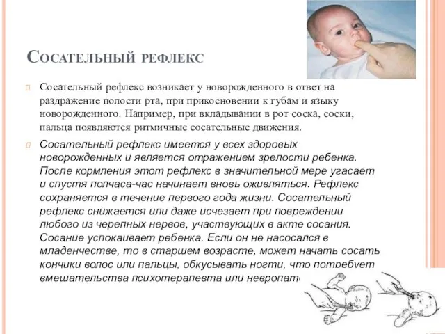 Сосательный рефлекс Сосательный рефлекс возникает у новорожденного в ответ на раздражение полости рта,
