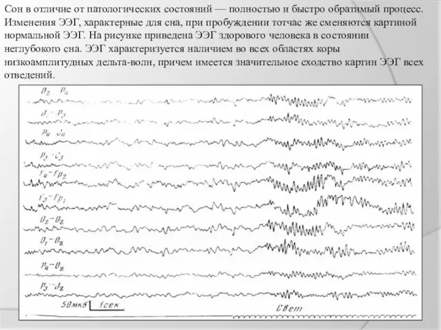 Сон в отличие от патологических состояний — полностью и быстро