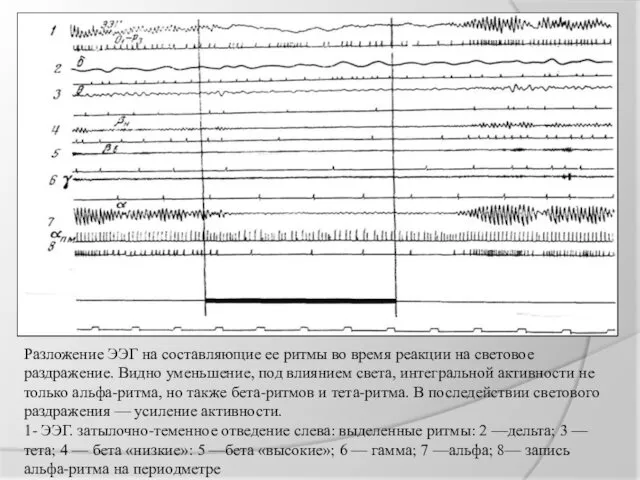 Разложение ЭЭГ на составляющие ее ритмы во время реакции на