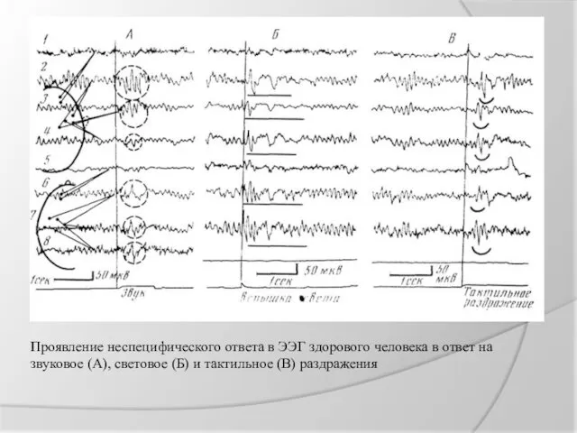Проявление неспецифического ответа в ЭЭГ здорового человека в ответ на