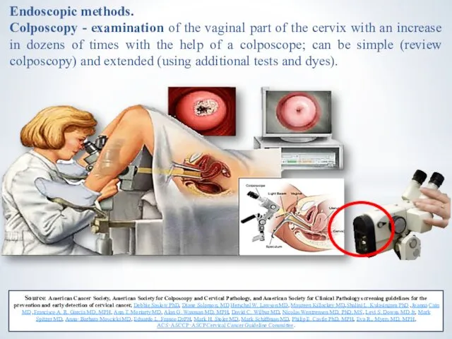 Endoscopic methods. Colposcopy - examination of the vaginal part of