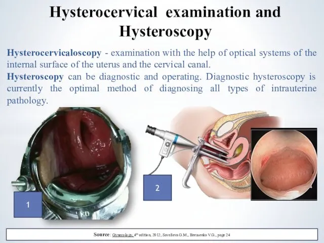 Hysterocervicaloscopy - examination with the help of optical systems of