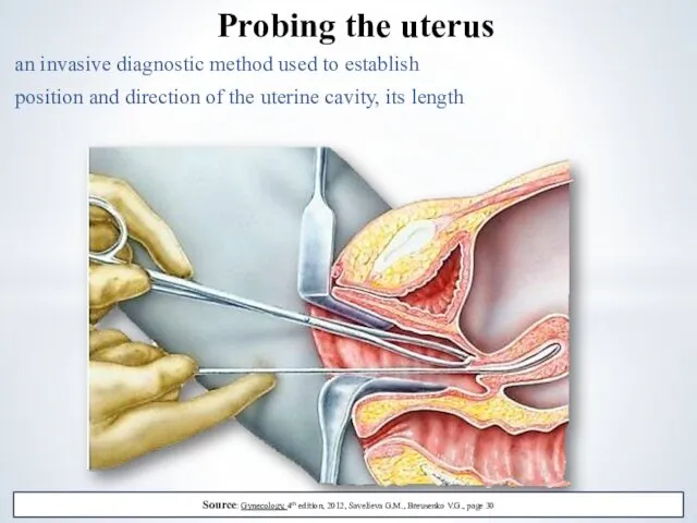 an invasive diagnostic method used to establish position and direction