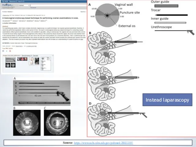 Instead laparascopy Source: https://www.ncbi.nlm.nih.gov/pubmed/29033397