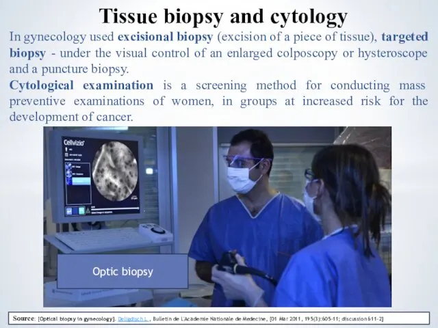 In gynecology used excisional biopsy (excision of a piece of