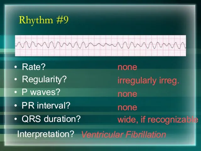 Rhythm #9 none Rate? Regularity? irregularly irreg. none wide, if recognizable P waves?