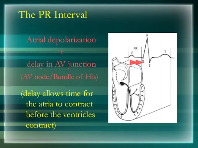 The PR Interval Atrial depolarization + delay in AV junction (AV node/Bundle of
