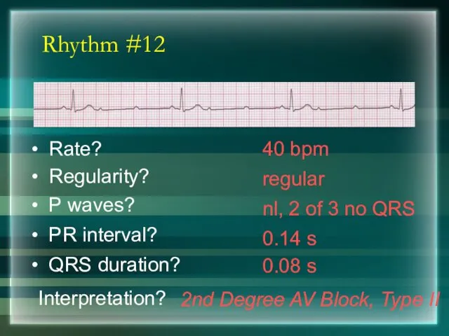 Rhythm #12 40 bpm Rate? Regularity? regular nl, 2 of 3 no QRS