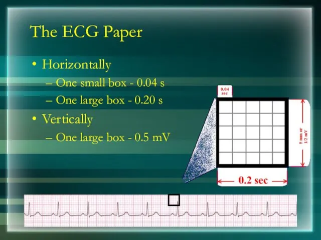The ECG Paper Horizontally One small box - 0.04 s One large box