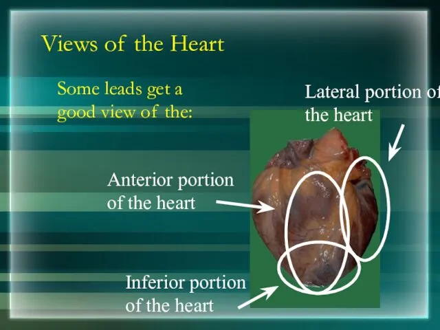 Views of the Heart Some leads get a good view