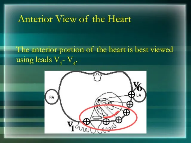 Anterior View of the Heart The anterior portion of the heart is best