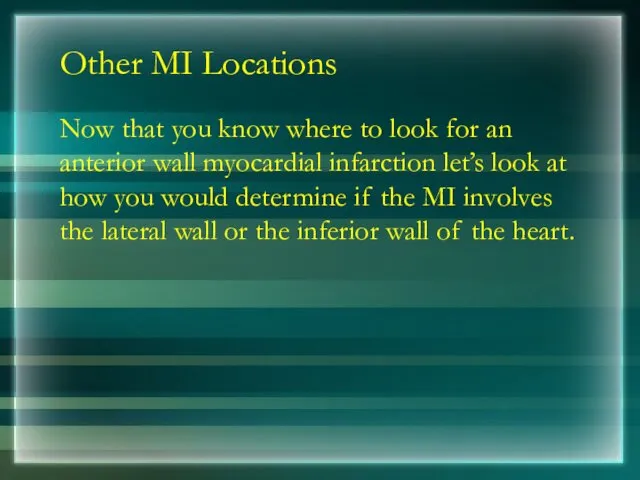 Other MI Locations Now that you know where to look for an anterior
