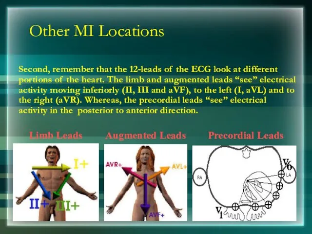 Other MI Locations Second, remember that the 12-leads of the ECG look at