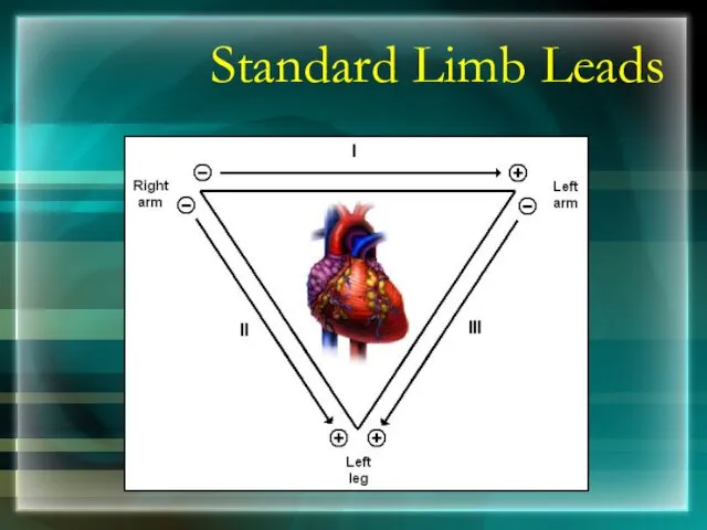 Standard Limb Leads
