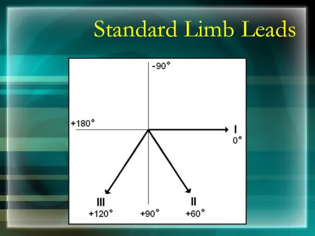 Standard Limb Leads