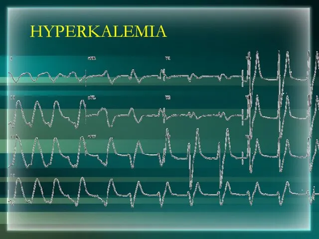 HYPERKALEMIA