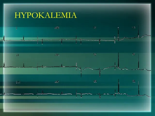 HYPOKALEMIA