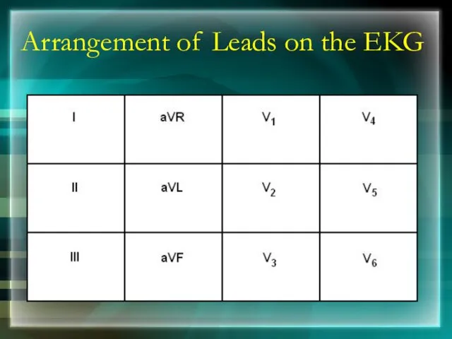 Arrangement of Leads on the EKG