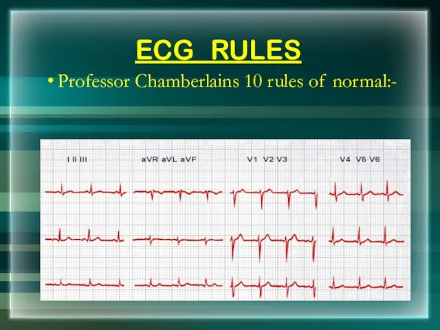ECG RULES Professor Chamberlains 10 rules of normal:-