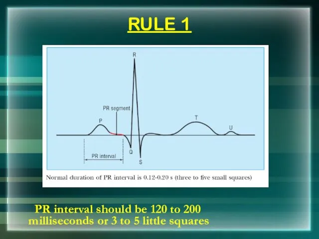 RULE 1 PR interval should be 120 to 200 milliseconds or 3 to 5 little squares