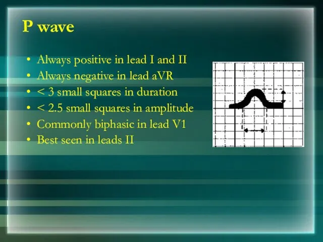 P wave Always positive in lead I and II Always
