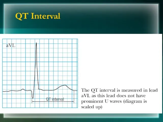 QT Interval