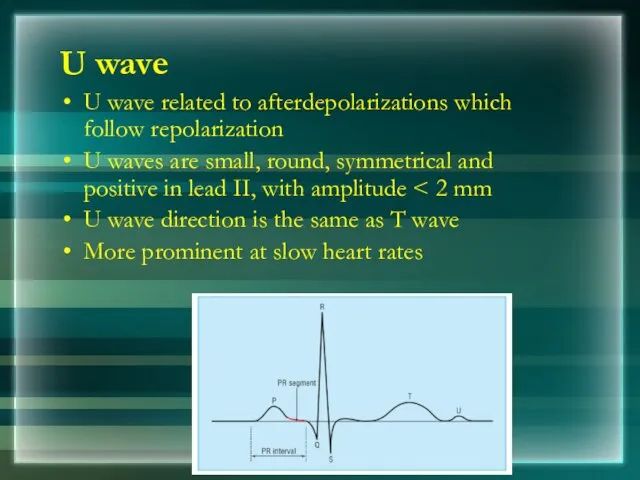 U wave U wave related to afterdepolarizations which follow repolarization U waves are