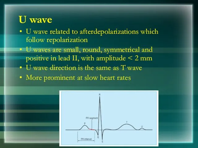 U wave U wave related to afterdepolarizations which follow repolarization