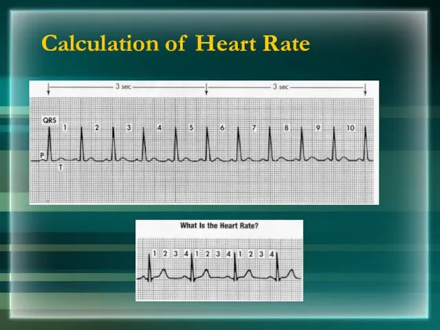 Calculation of Heart Rate