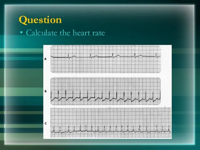 Question Calculate the heart rate
