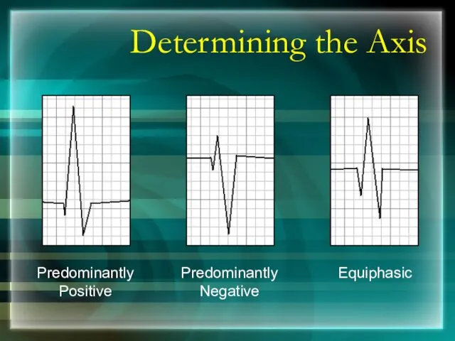 Determining the Axis Predominantly Positive Predominantly Negative Equiphasic