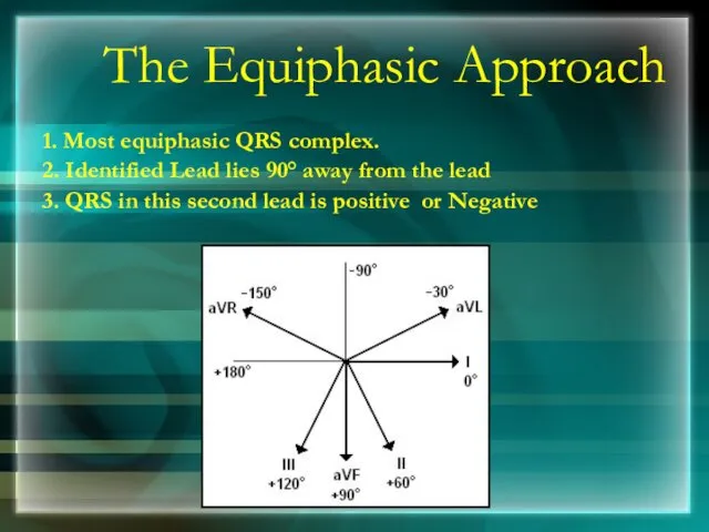 The Equiphasic Approach 1. Most equiphasic QRS complex. 2. Identified Lead lies 90°