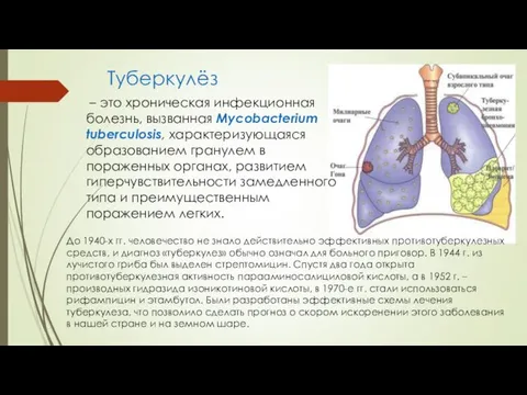 Туберкулёз – это хроническая инфекционная болезнь, вызванная Mycobacterium tuberculosis, характеризующаяся