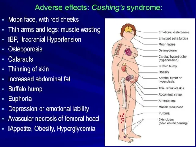 Adverse effects: Cushing’s syndrome: Moon face, with red cheeks Thin arms and legs: