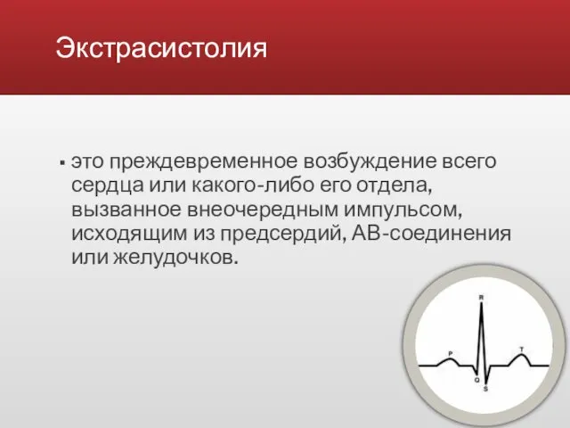 Экстрасистолия это преждевременное возбуждение всего сердца или какого-либо его отдела,