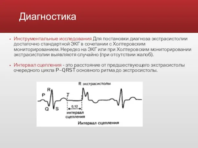 Диагностика Инструментальные исследования Для постановки диагноза экстрасистолии достаточно стандартной ЭКГ