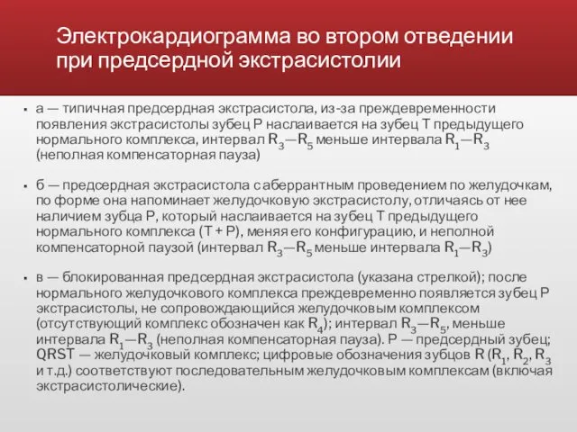 Электрокардиограмма во втором отведении при предсердной экстрасистолии а — типичная