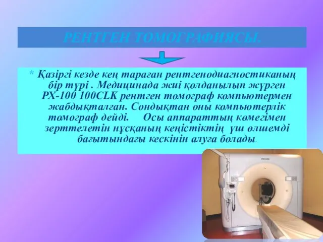 Қазіргі кезде кең тараған рентгенодиагностиканың бір түрі . Медицинада жиі