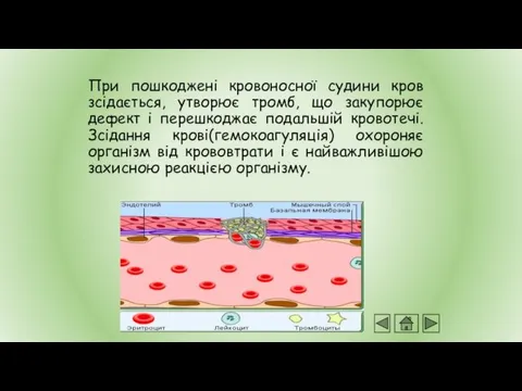 При пошкоджені кровоносної судини кров зсідається, утворює тромб, що закупорює