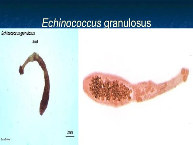 Echinococcus granulosus