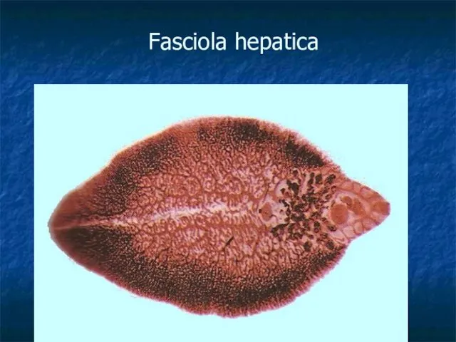 Fasciola hepatica