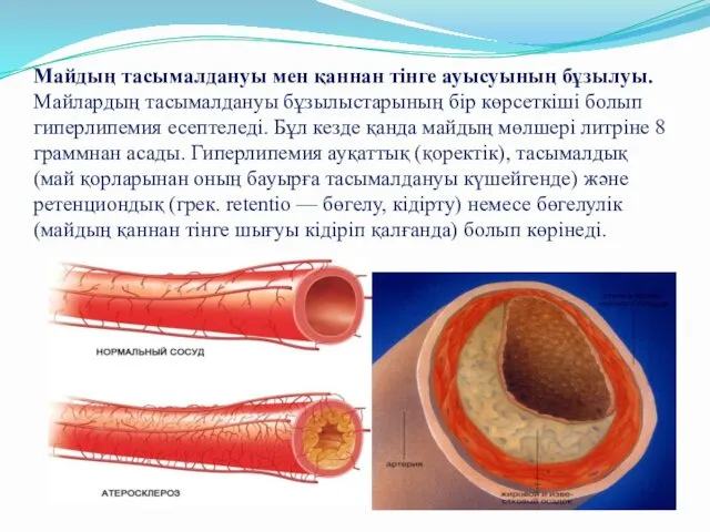 Майдың тасымалдануы мен қаннан тінге ауысуының бұзылуы. Майлардың тасымалдануы бұзылыстарының