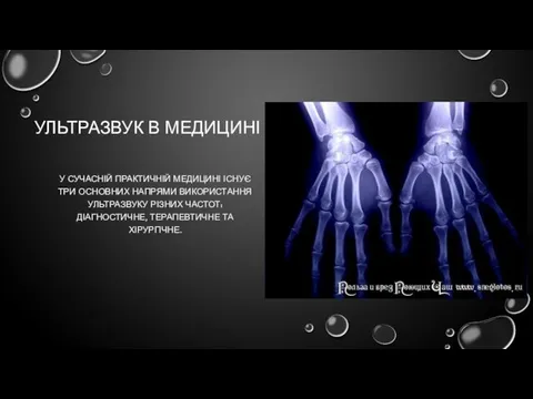 УЛЬТРАЗВУК В МЕДИЦИНІ У СУЧАСНІЙ ПРАКТИЧНІЙ МЕДИЦИНІ ІСНУЄ ТРИ ОСНОВНИХ НАПРЯМИ ВИКОРИСТАННЯ УЛЬТРАЗВУКУ