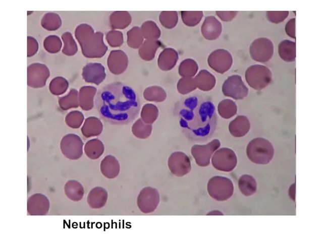 Neutrophils