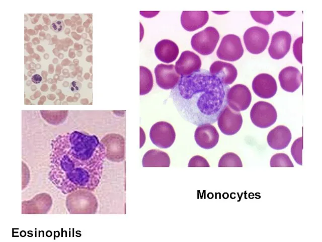 Eosinophils Monocytes