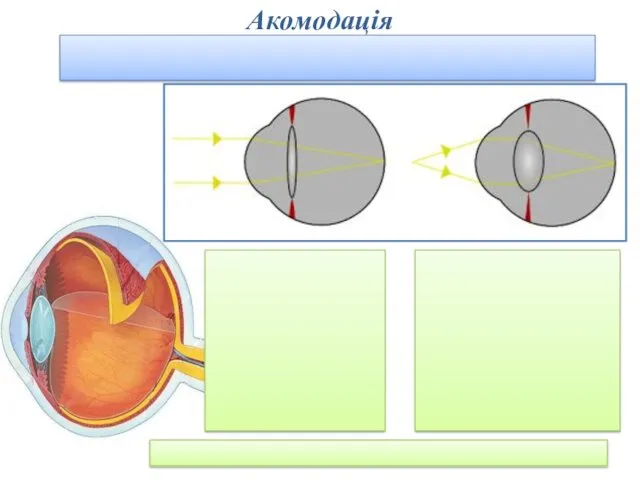 Акомодація