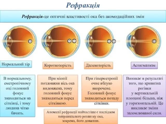 Рефракція Рефракція-це оптичні властивості ока без акомодаційних змін В нормальному, еметропічному оці головний