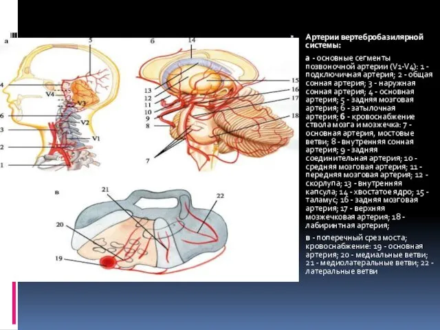 Артерии вертебробазилярной системы: а - основные сегменты позвоночной артерии (V1-V4):