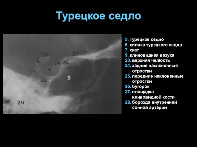 Турецкое седло 5. турецкое седло 6. спинка турецкого седла 7.